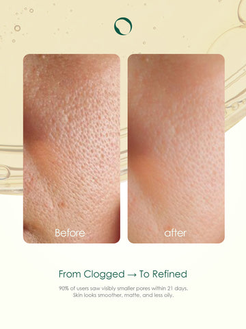 Pore Serum